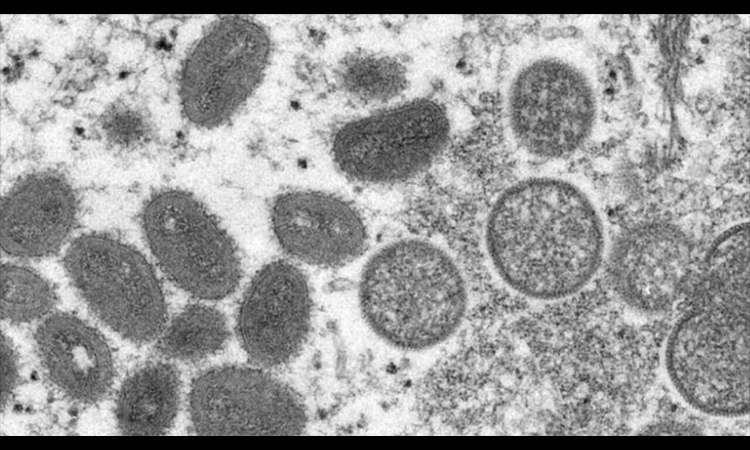 Número de casos suspeitos de varíola dos macacos no Brasil sobe para seis
