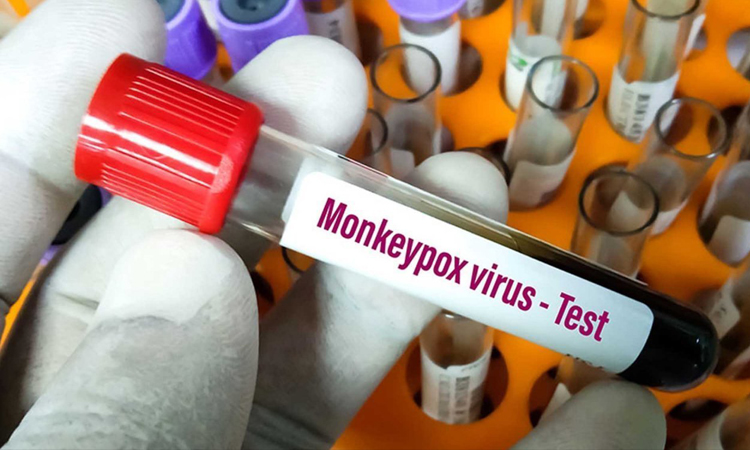 Ministério da Saúde confirma primeira morte por varíola dos macacos no Brasil